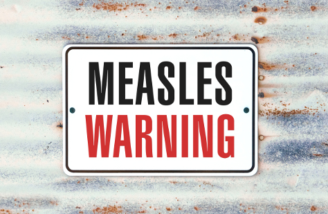 Measles 474