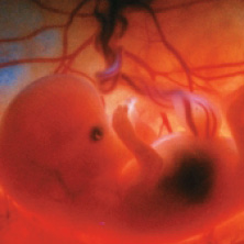 embryo at 9 weeks old