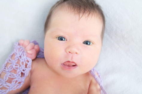 tongue-tie in babies