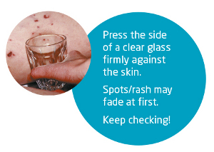Meningitis glass test