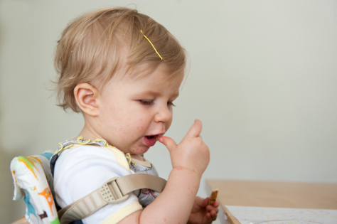 Hand foot and mouth disease 474