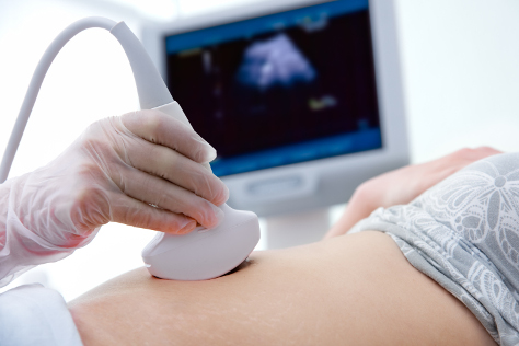 Pregnant woman having scan