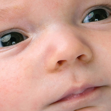 common-baby-skin-conditions
